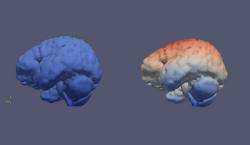 brain_deformation